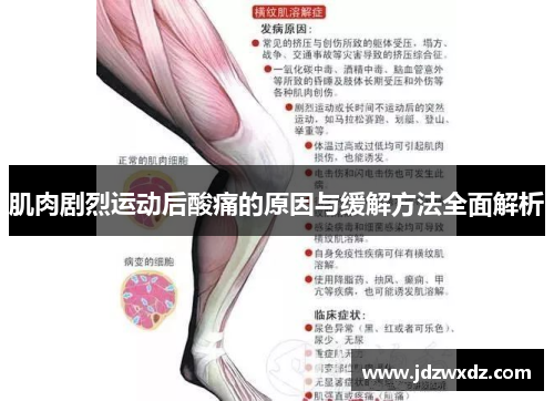 肌肉剧烈运动后酸痛的原因与缓解方法全面解析
